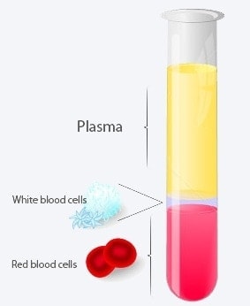 Bild zeigt Implanter