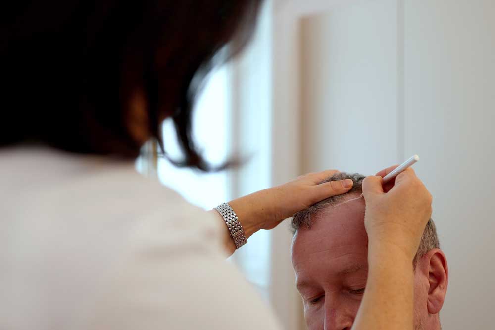 Bild zeigt Implanter