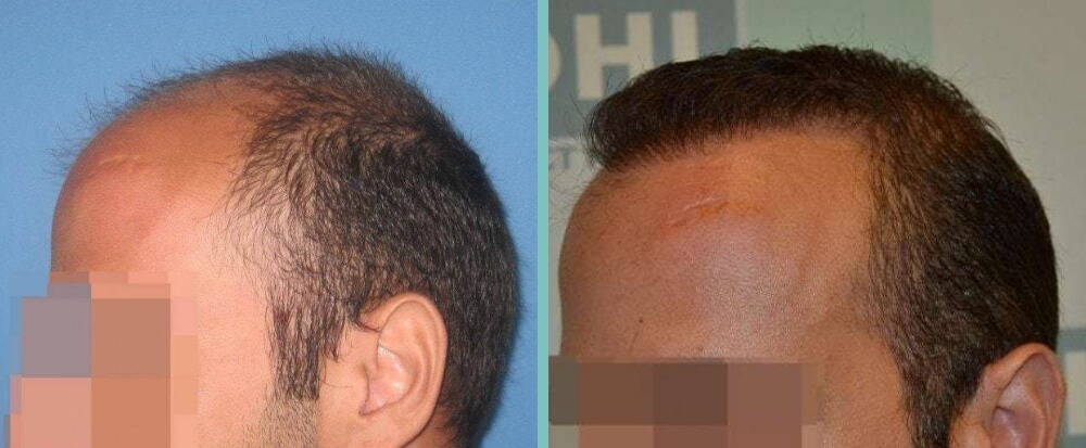 Vorher Nachher – Andy C.