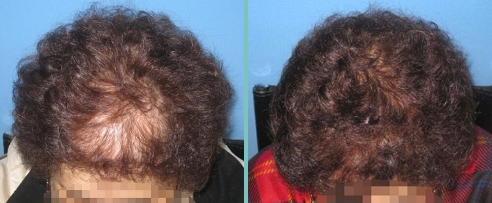 Vorher Nachher – Margit A.