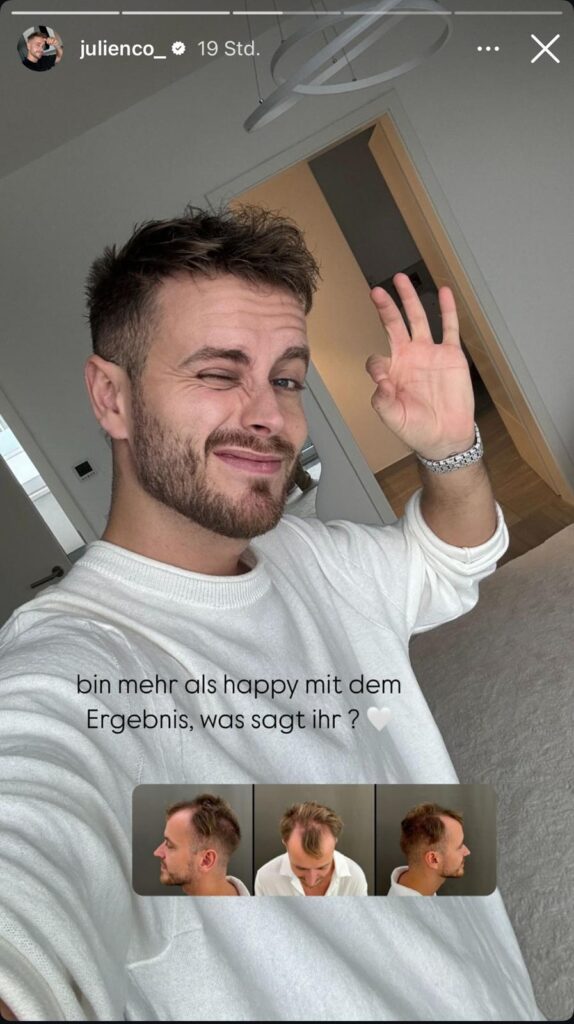 Juienco Influencer vier Monate nach HT