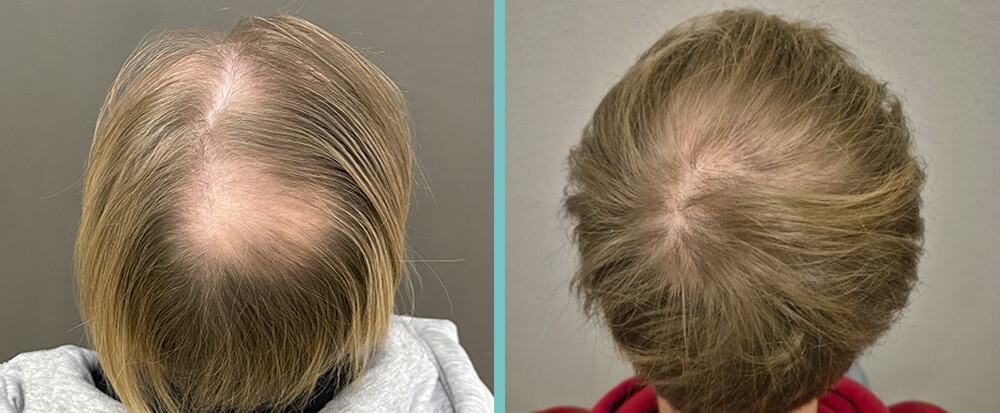 Vorher Nachher – Daniel S.